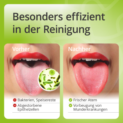 Tongue Cleaner – Stainless Steel Tongue Scraper